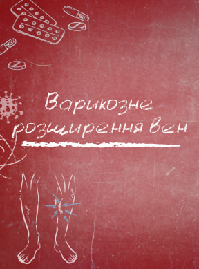 Варикозне розширення вен