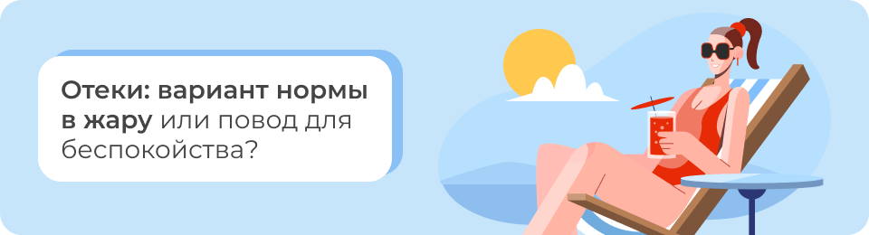 Отеки: вариант нормы в жару или повод для беспокойства?