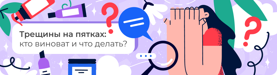 Трещины на пятках: кто виноват и что делать?