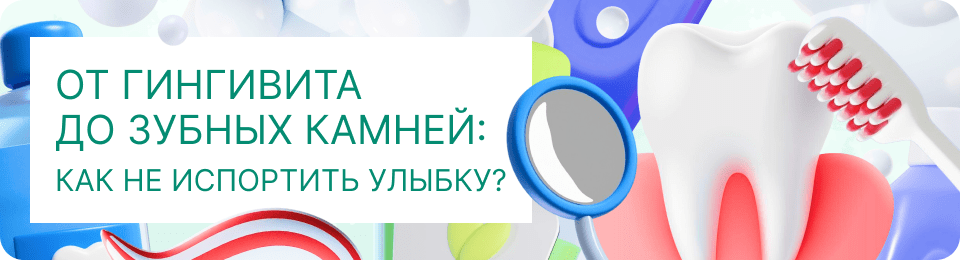 От гингивита до зубных камней: как не испортить улыбку?