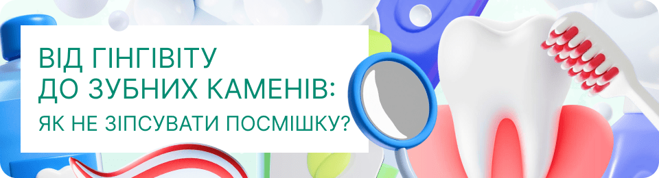 Від гінгівіту до зубних каменів: як не зіпсувати посмішку?